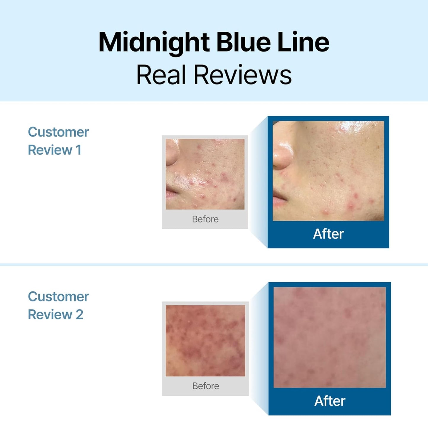 DearKlairs Midnight Blue Calming Cream | Face Moisturizer for Redness Relief, Guaiazulene, EGF & Ceramide, Non-Greasy Post-Treatment Recovery, Korean Vegan Skincare for Sensitive Skin, 2.11 oz