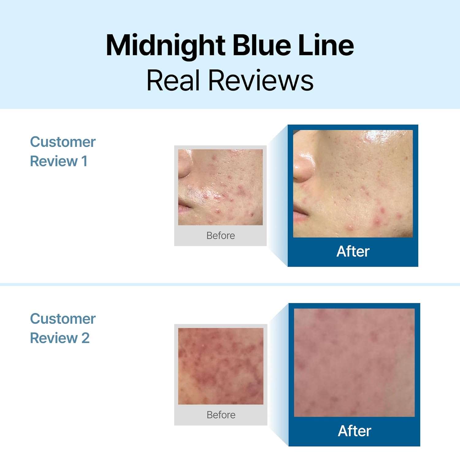 DearKlairs Midnight Blue Calming Cream | Face Moisturizer for Redness Relief, Guaiazulene, EGF & Ceramide, Non-Greasy Post-Treatment Recovery, Korean Vegan Skincare for Sensitive Skin, 2.11 oz
